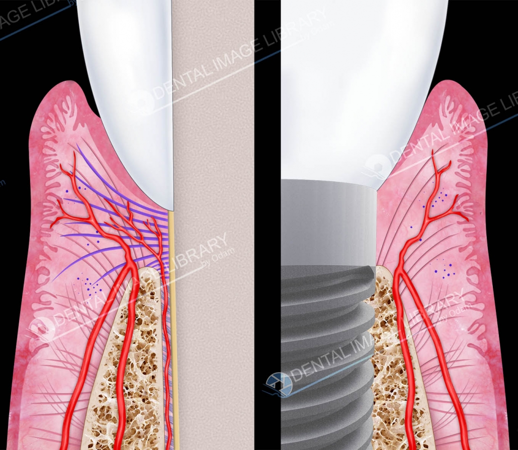 Gingival vessels of natural tooth versus dental implant. 62JB00010