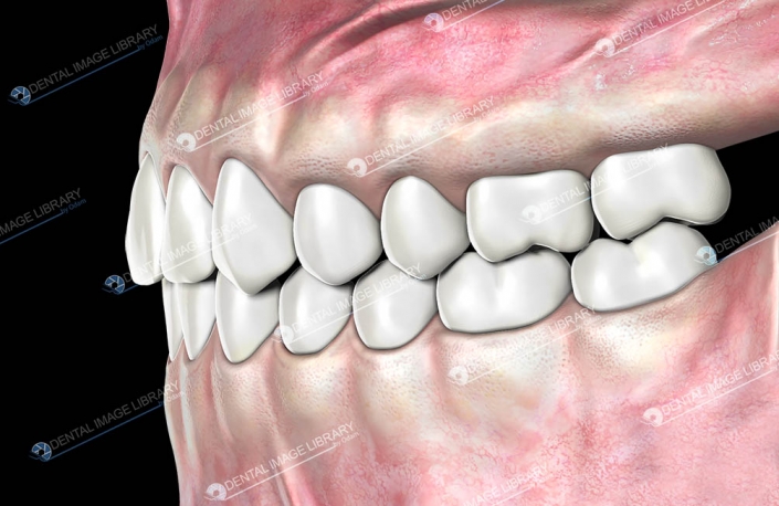 normal-occlusion-class-1-93jb00004-dental-image-library